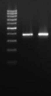 Frequency of <i>Chlamydia trachomatis</i>, <i>Mycoplasma genitalium</i>, and <i>Ureaplasma urealyticum</i> Isolated From Vaginal Samples of Women in Kerman, Iran