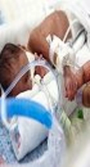 Evaluation of the Relationship Between Perceived Nursing Support and Parental Stress Among Mothers of Hospitalized Preterm Infants in Neonatal Intensive Care Units