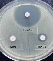 Jundishapur J Microbiol