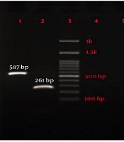 Jundishapur J Microbiol