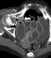 Iranian Journal of Radiology 
