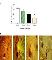 Jundishapur Journal of Natural Pharmaceutical Products