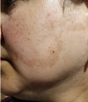 J Skin Stem Cell