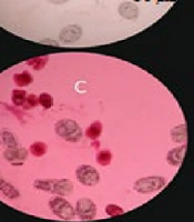 Jundishapur J Nat Pharm Prod