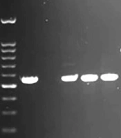 Jundishapur Journal of Microbiology 