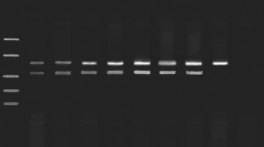 Simultaneous Amplification of HSV DNA and IAC for Limit Detection M: SM1108 DNA ladder (MBI Fermentas, USA) Lane 1, positive control, Lane 2, 1000000 copies/mL, Lane 3, 100000 copies/mL, Lane 4, 10000 copies/mL, Lane 5: 5000 copies/mL, Lane 6, 2500 copies/mL, Lane 7: 500 copies/mL, Lane 8:50 copies/mL, Lane 9: negative control. Lane 2-8 contains 103 copies of IAC plasmids.