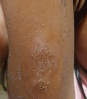 J Skin Stem Cell