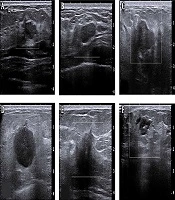 Iranian Journal of Radiology