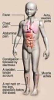 Approach to Growing Pains in Childhood in a Familial Mediterranean Fever Endemic Region