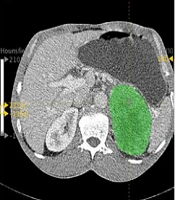 Iranian Journal of Radiology