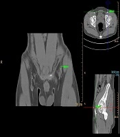 Iranian Journal of Radiology