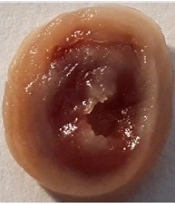 Int J Endocrinol Metab