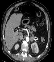 Int J Endocrinol Metab