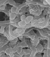 Jundishapur J Microbiol