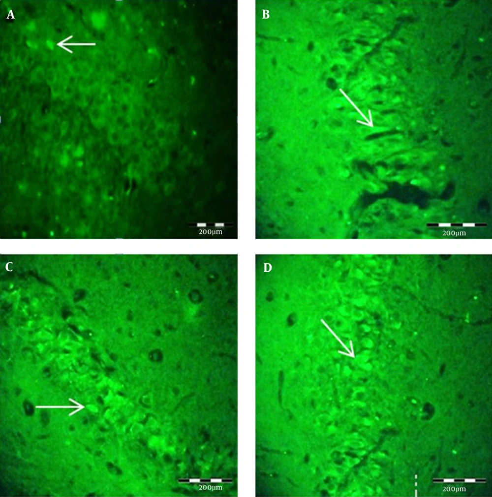 BrdU Staining of the DG Area for Control and Trial Groups Significant difference in cell proliferation was seen. A, (control M L/D); B, (control F L/D); C, (F/TLD); D, (M/TLD).