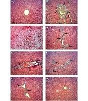 Hepatitis Monthly