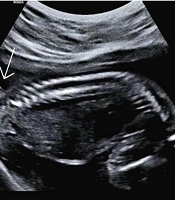 Fertil Gynecol Androl