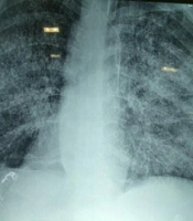 Arch Clin Infect Dis