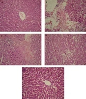Jundishapur Journal of Natural Pharmaceutical Products