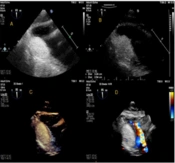 Multidiscip Cardio Annal
