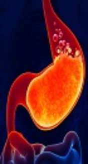 Pro-Oxidant and Antioxidant Balance, Anthropometric Parameters, and Nutrient Intakes in Gastro-Esophageal Reflux Disease Patients