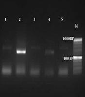 Jundishapur Journal of Microbiology