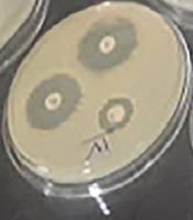 Jundishapur Journal of Microbiology