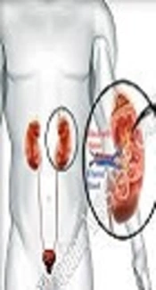 Serum Heat Shock Protein Levels in IgA Nephropathy