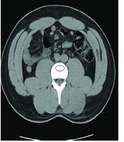 Iranian Journal of Radiology