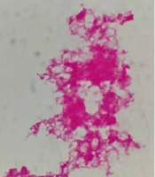 Jundishapur J Microbiol