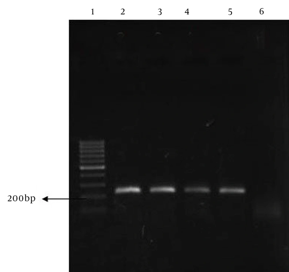 PCR Amplification of 210 bps of <i>gyrA</i> Gene Lane 1, molecular sized marker (100 bp DNA ladder); lane 2, <i>gyrA</i> PCR product from <i>M. abscessus</i>; lane 3, <i>gyrA</i> PCR product from <i>M. gordonae</i>; lanes 4 - 5, <i>gyrA</i> product from <i>M. fortuitum</i> ATCC49403 and <i>M. fortuitum</i>; lane 6, <i>gyrA</i> negative control.