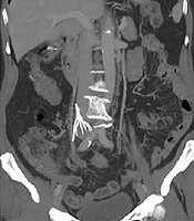 Iranian Journal of Radiology