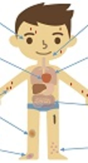 Drug Hypersensitivity Reactions in Hospital-Admitted Children: A Single Center Study in Southern Iran
