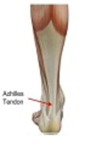Effects of Two Plyometric Protocols at Different Surfaces on Mechanical Properties of Achilles Tendon in Children