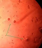 Jundishapur Journal of Microbiology