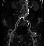Iranian Journal of Radiology