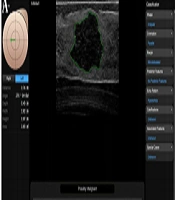 Iranian Journal of Radiology