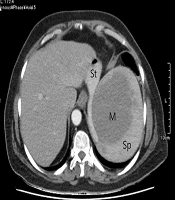 International Journal of Cancer Management