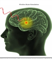 Interv Pain Med Neuromod