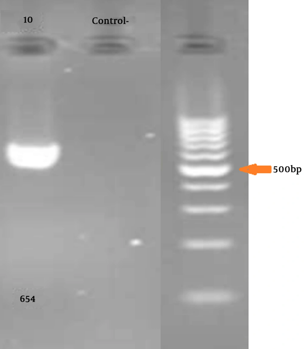 The picture indicates exon 10 with 654 bp length and negative control for the same PCR The picture indicates exon 10 with 654 bp length and negative control for the same PCR