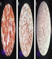 International Journal of Cancer Management