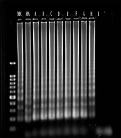Jundishapur Journal of Microbiology