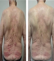 Journal of Skin and Stem Cell