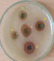 Gene Cell Tissue