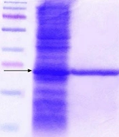 Jundishapur J Microbiol