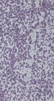Emergence of <i>Staphylococcus epidermidis</i> Clinical Isolates with Resistance to Both Mupirocin and Fusidic Acid
