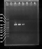 Jundishapur J Microbiol