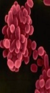 Brucella melitensis, Kenyon College
