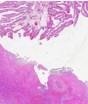 Zahedan J Res Med Sci