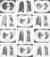 Iranian Journal of Radiology